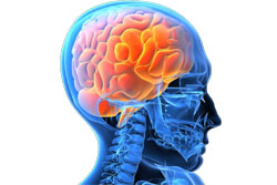 Making Sense of Brain Tumour